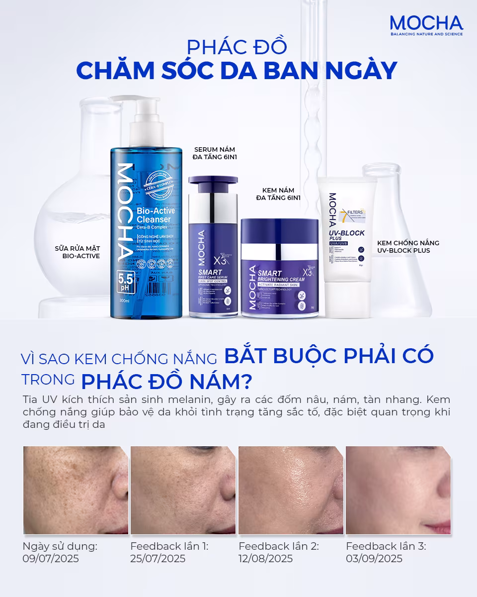 Lời khuyên bác sĩ: Cách chăm sóc da nám sau sinh hiệu quả