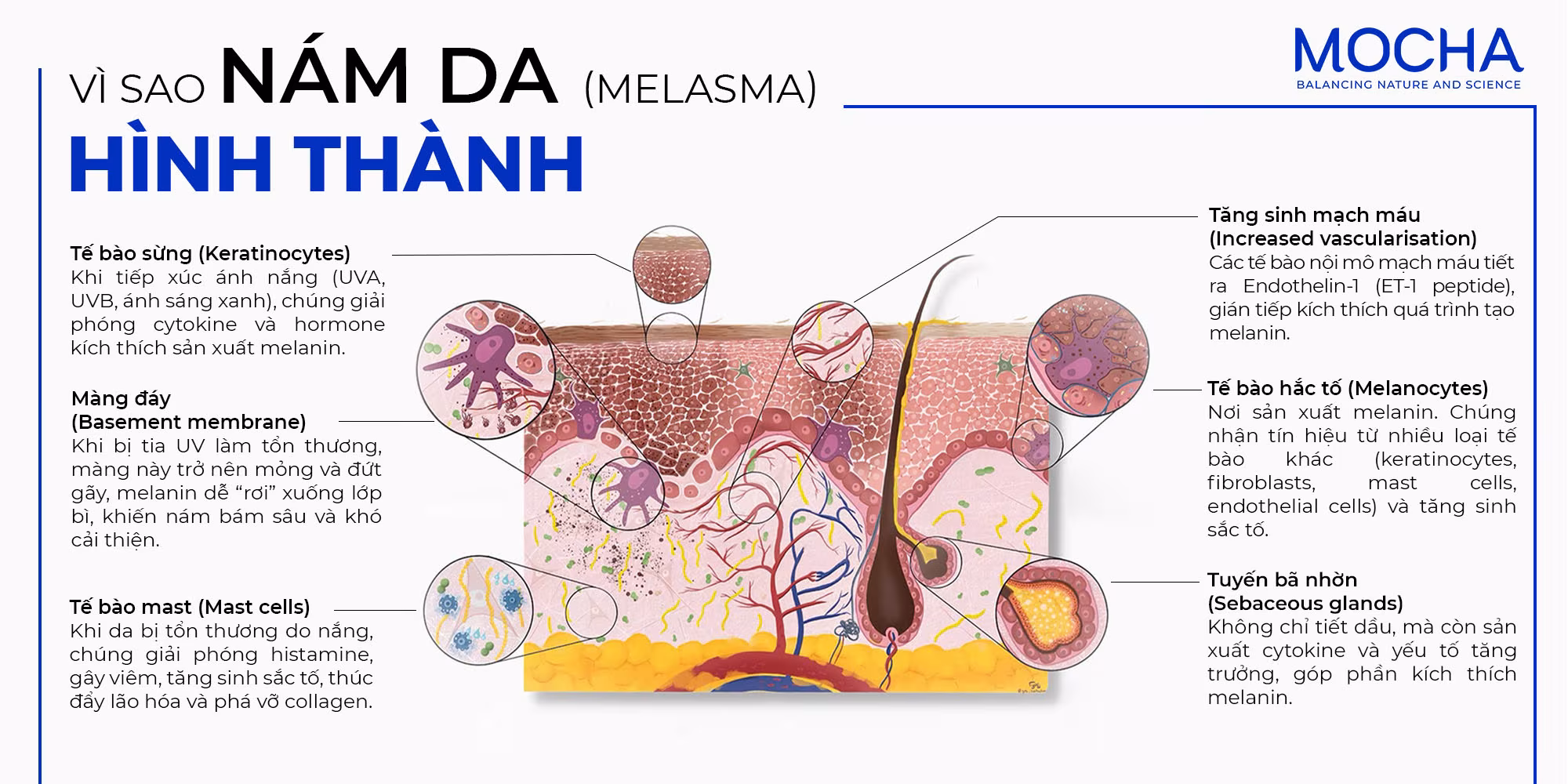 NHẬN BIẾT NÁM DA TỪ SỚM – GIẢI PHÁP GIẢM NÁM NHANH, AN TOÀN