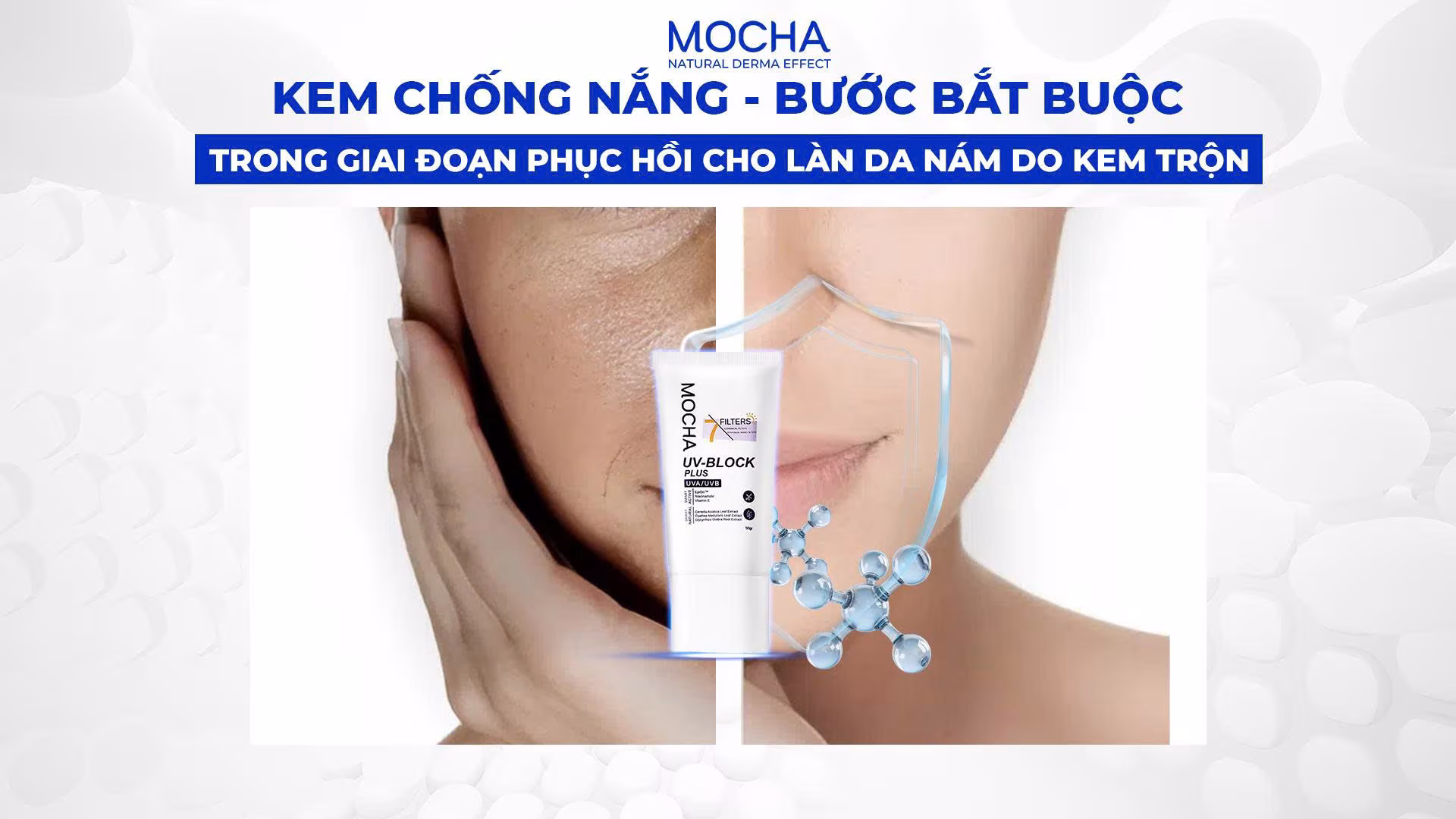 Kem chống nắng – Bước bắt buộc trong giai đoạn phục hồi cho làn da nám do kem trộn