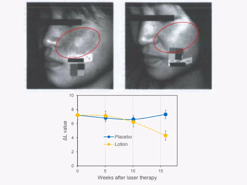Actosome Whitenol - Hoạt chất làm sáng da thế hệ mới 6 Actosome Whitenol – Hoạt chất làm sáng da thế hệ mới