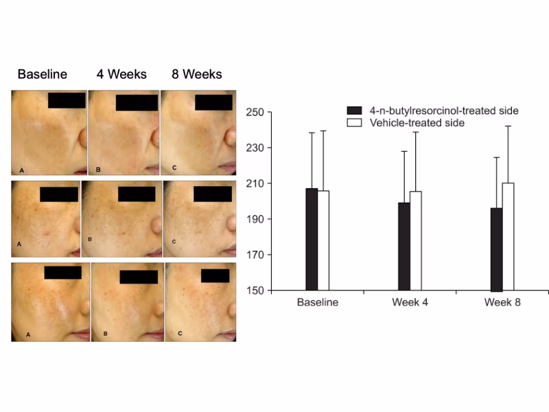 Actosome Whitenol - Hoạt chất làm sáng da thế hệ mới 4 Actosome Whitenol – Hoạt chất làm sáng da thế hệ mới