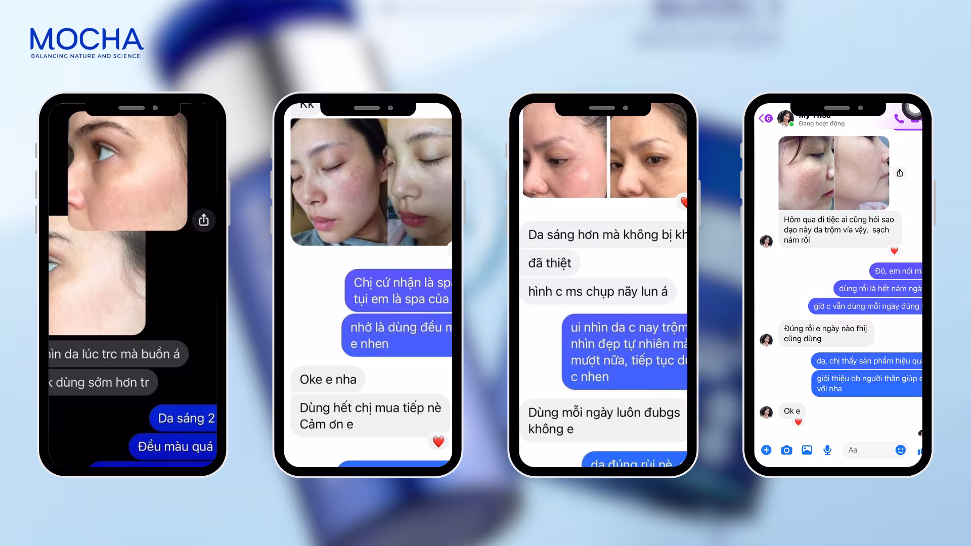 Combo trị nám Mocha: Xóa sổ nám sạm, phục hồi da chỉ sau 4 tuần