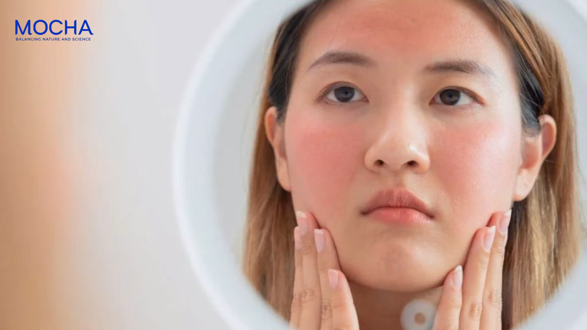 Review kem trị nám Mocha: Cứu cánh cho làn da nám mỏng yếu, tổn thương