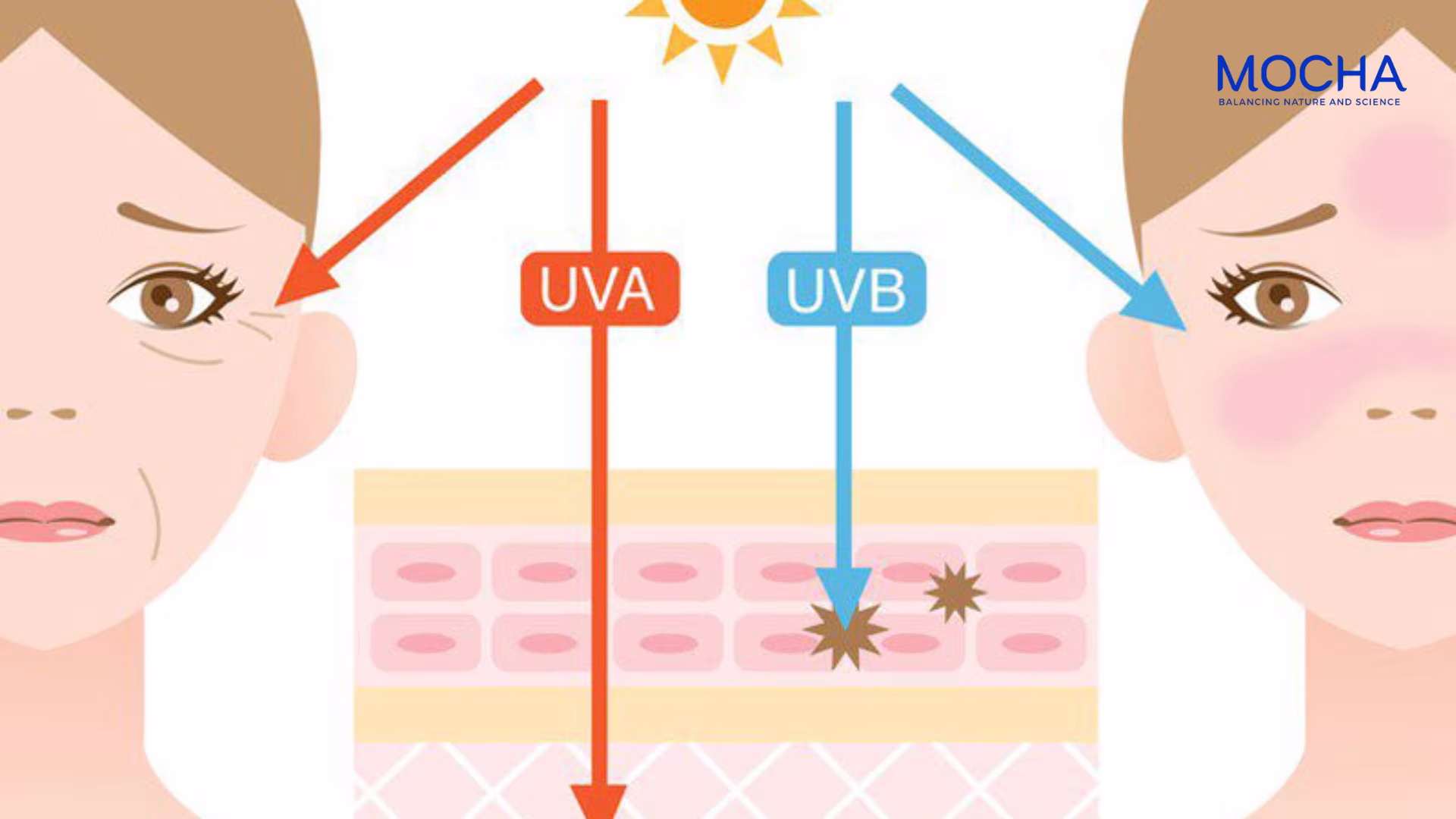 Cách nhận biết và điều trị nám mảng hiệu quả stại nhà