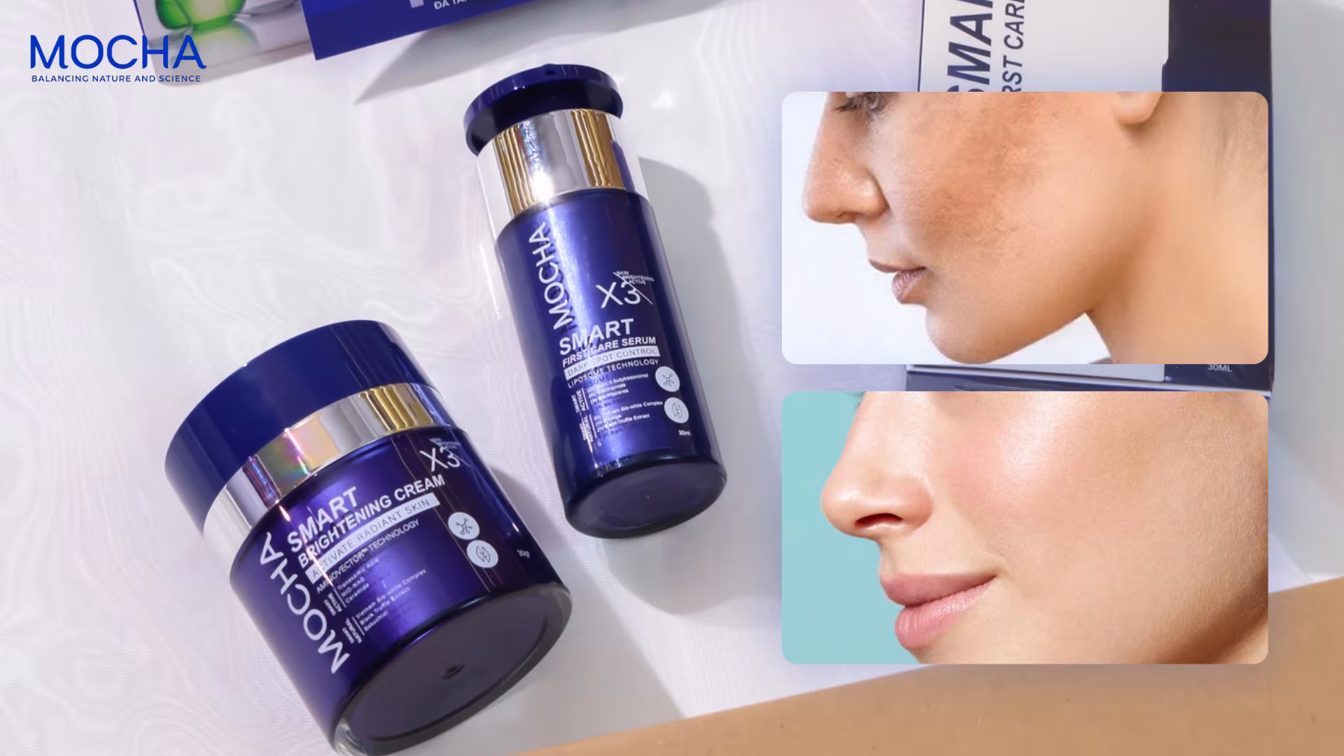 5 nguyên nhân gây nám da hàng đầu mà phụ nữ Việt thường bỏ qua