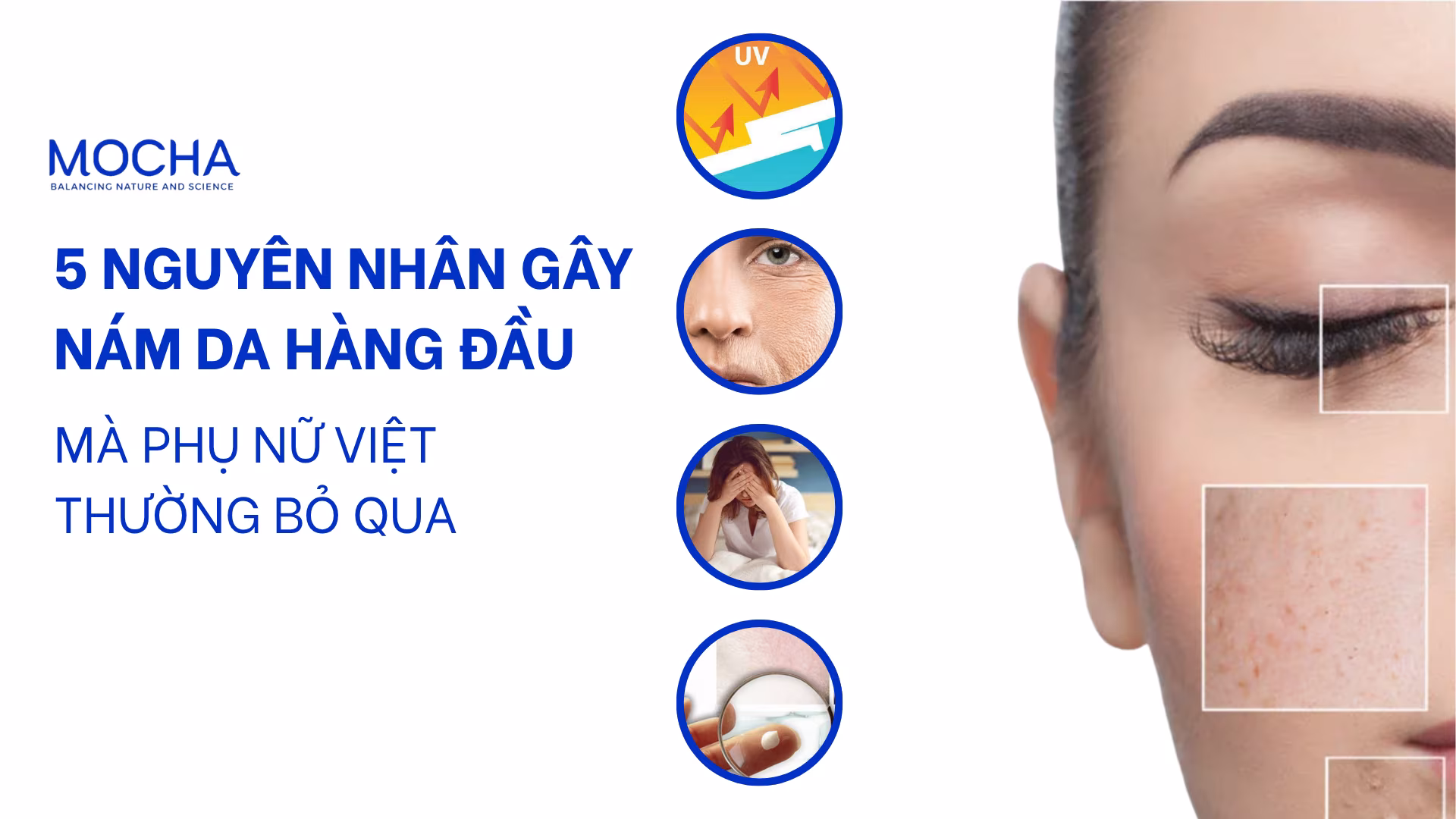5 nguyên nhân gây nám da hàng đầu mà phụ nữ Việt thường bỏ qua
