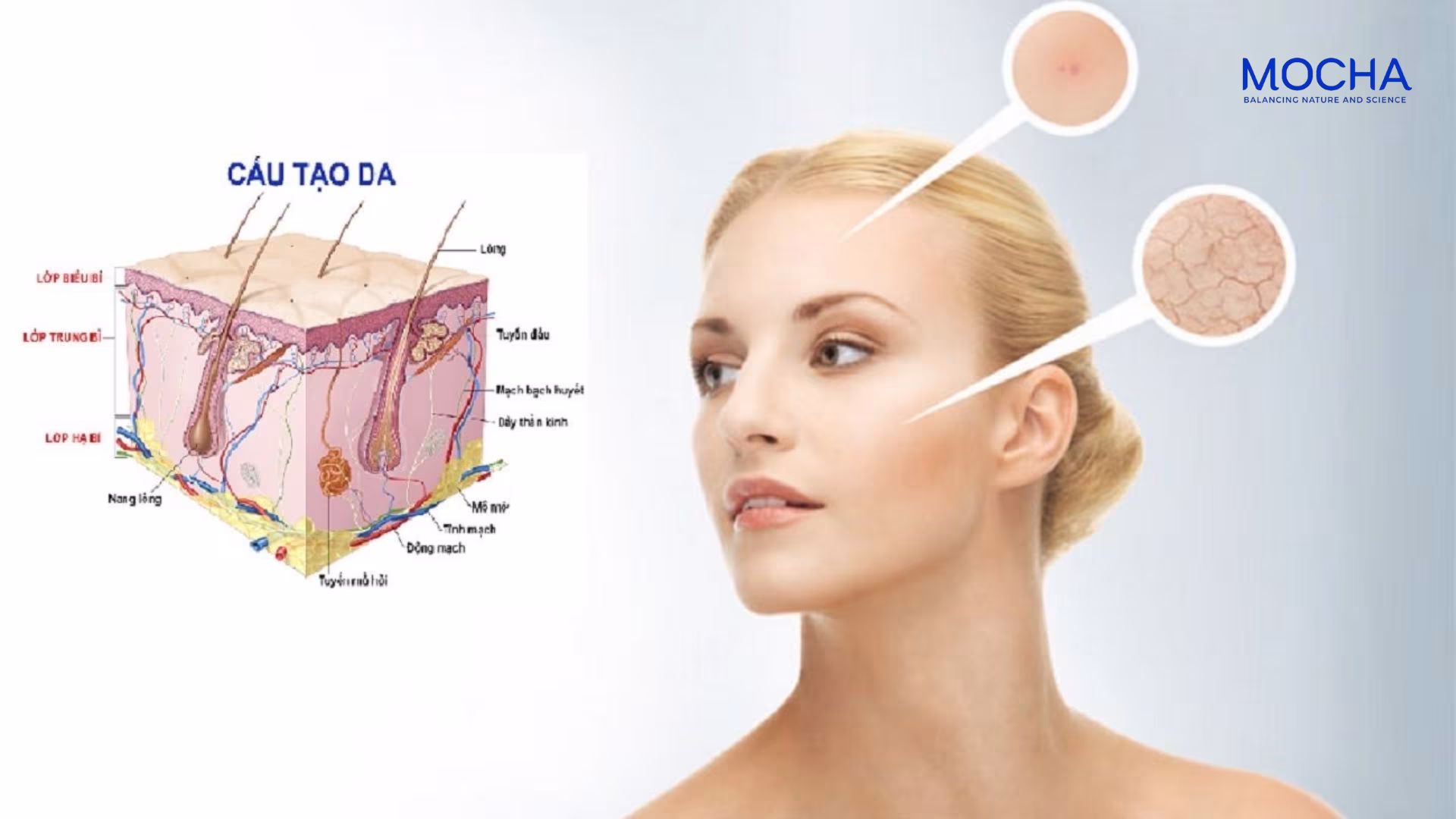 Phác đồ nám Mocha: Cơ chế 3 tầng giúp ngăn ngừa nám tái phát