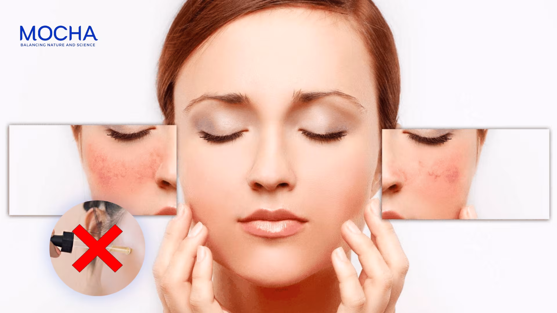 Cách chăm sóc da sau peel 7 ngày phục hồi nhanh và trắng sáng