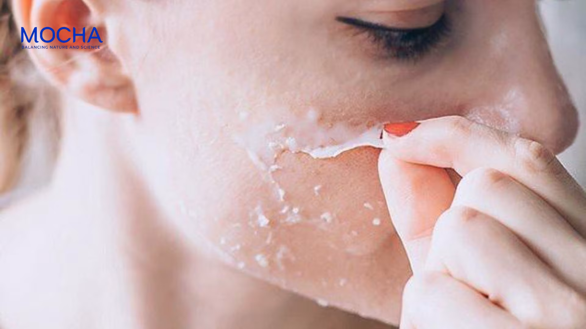 Cách chăm sóc da sau peel 7 ngày phục hồi nhanh và trắng sáng