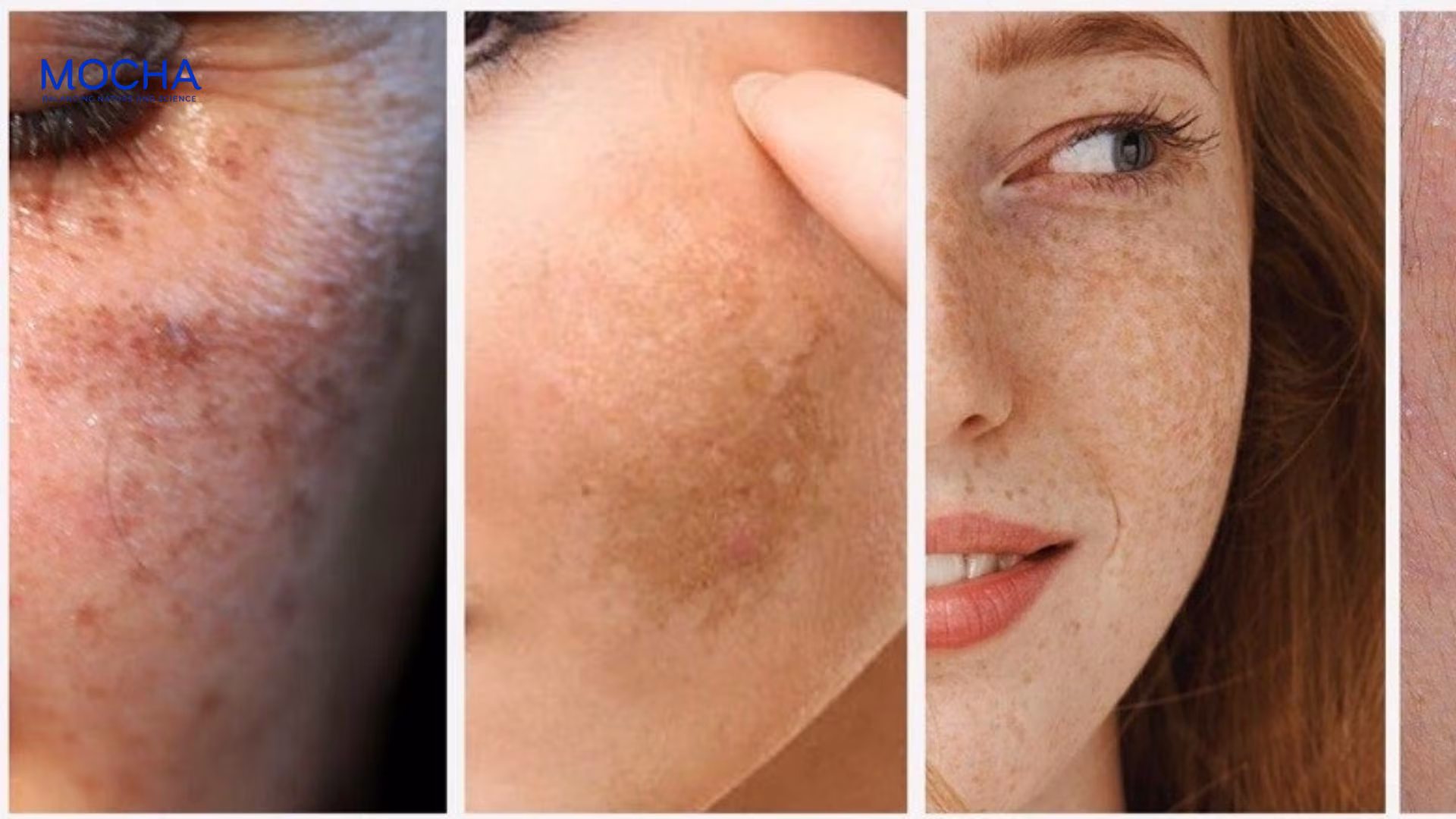 3 lý do chống nắng ngừa nám là bước quan trọng nhất trong ngày