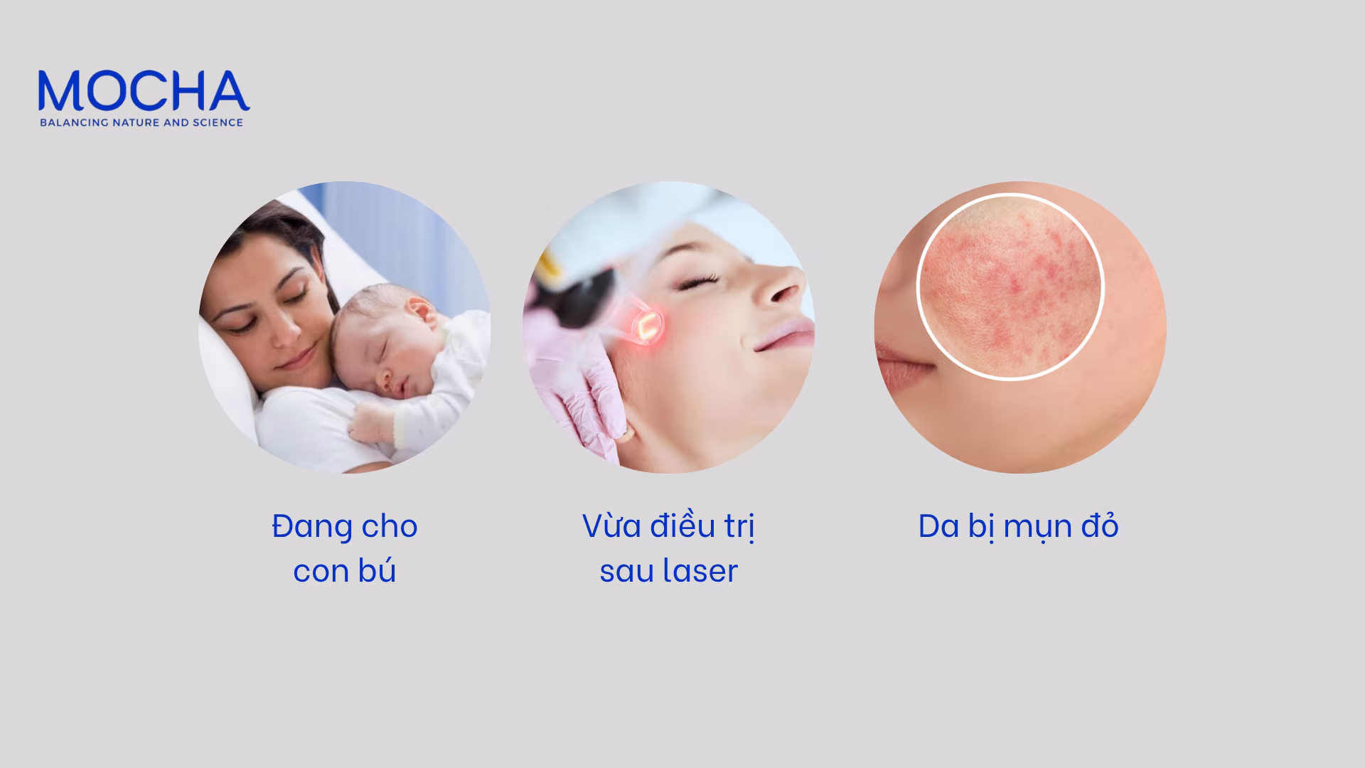 Da mỏng yếu có nên peel da không và 4 bí quyết an toàn khi peel