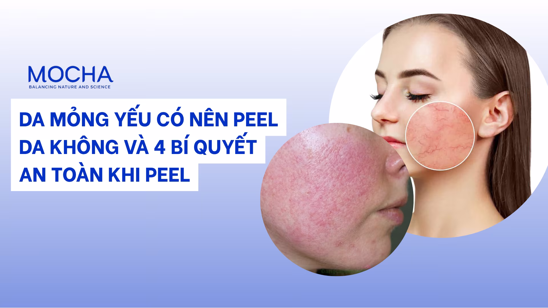 Da mỏng yếu có nên peel da không và 4 bí quyết an toàn khi peel