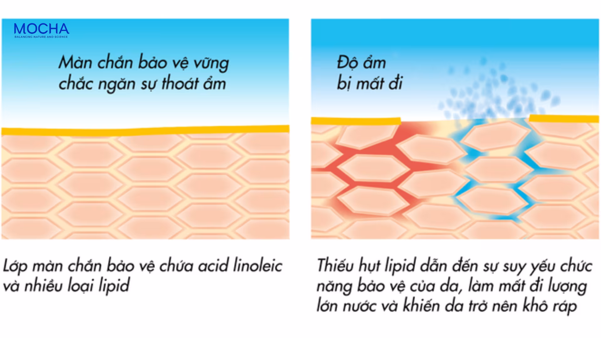 3 cách lựa chọn dưỡng ẩm da nhạy cảm không gây bí tắc lỗ chân lông