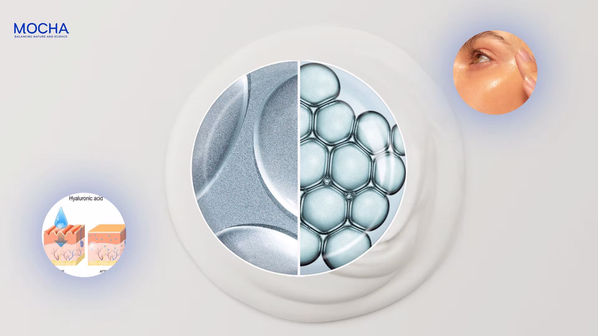 3 cách lựa chọn dưỡng ẩm da nhạy cảm không gây bí tắc lỗ chân lông