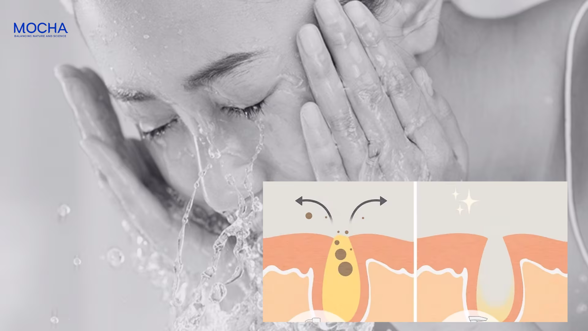 3 cách lựa chọn dưỡng ẩm da nhạy cảm không gây bí tắc lỗ chân lông