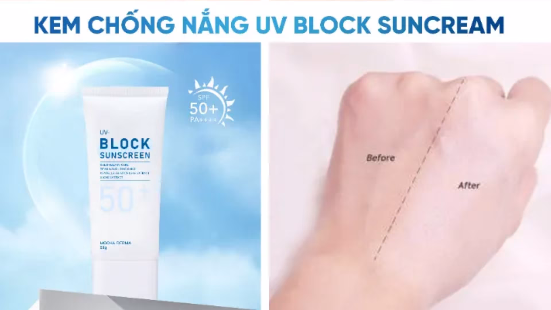 5 lý do da đang điều trị nám bắt buộc phải dùng kem chống nắng phổ rộng