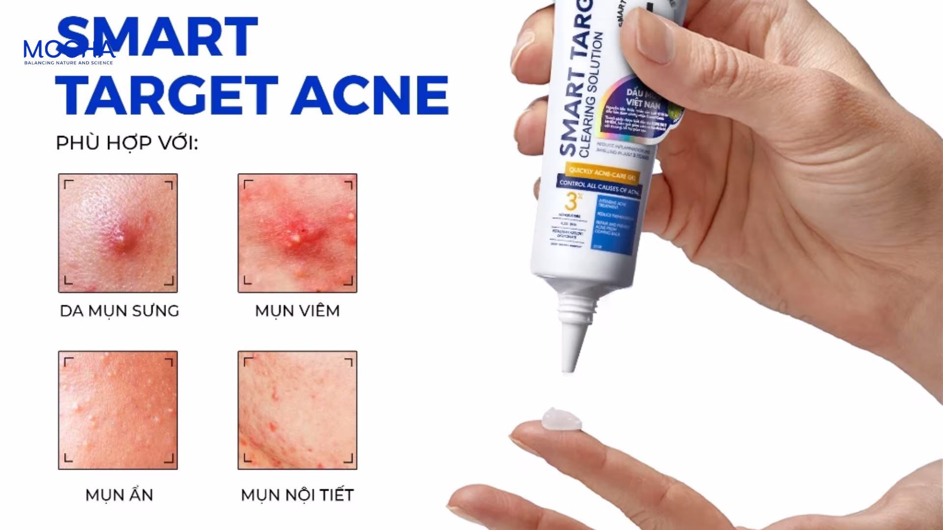 Review 3 đặc điểm kem trị mụn Mocha giúp giảm sưng viêm và gom cồi mụn nhanh chóng