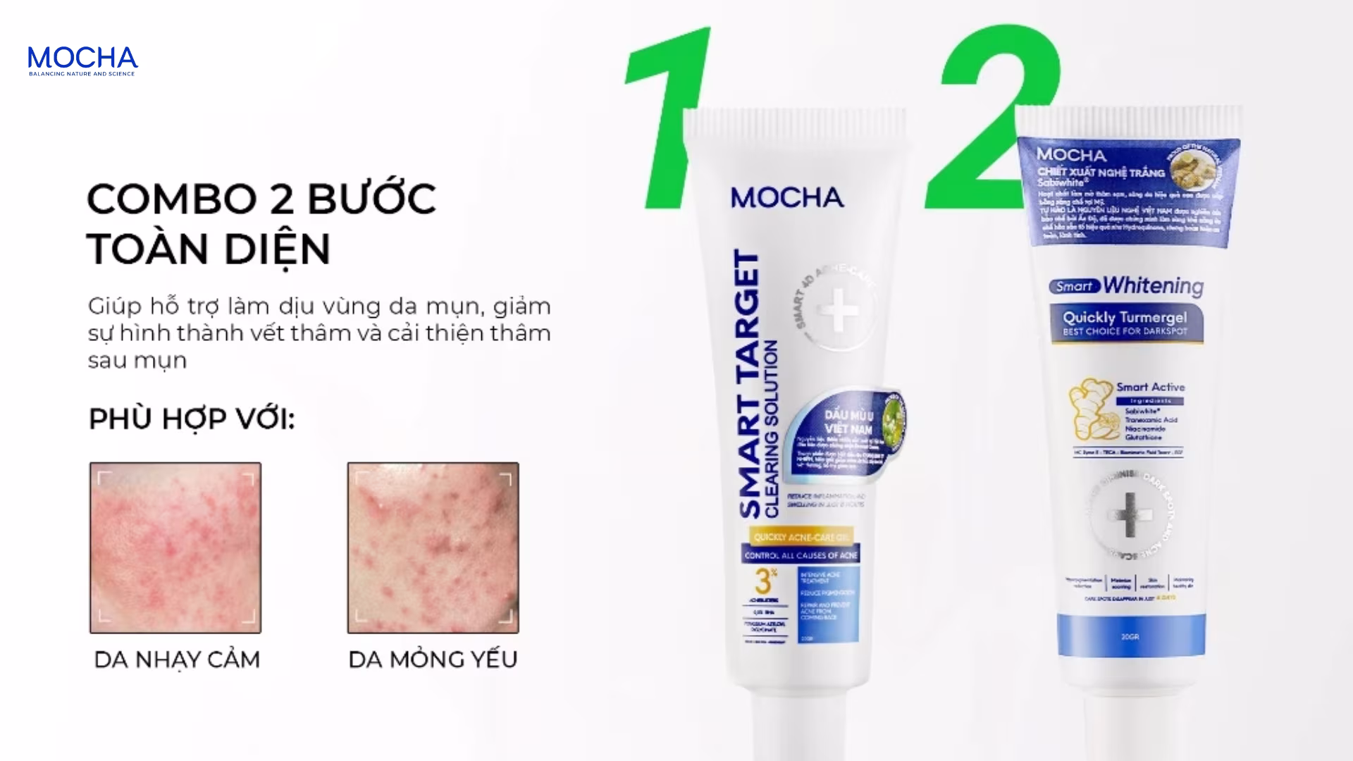 Kem trị thâm Mocha: 7 công dụng mờ thâm mụn, làm sáng và đều màu da hiệu quả