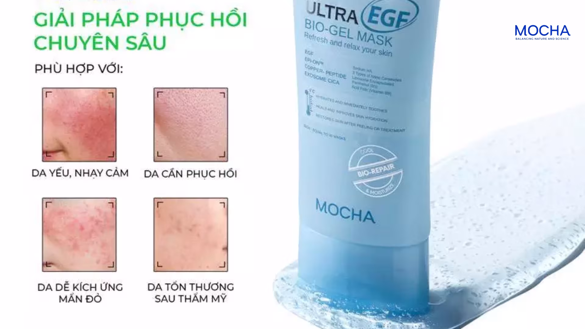 4 thời điểm nên sử dụng mặt nạ phục hồi trong quy trình trị nám chuyên sâu