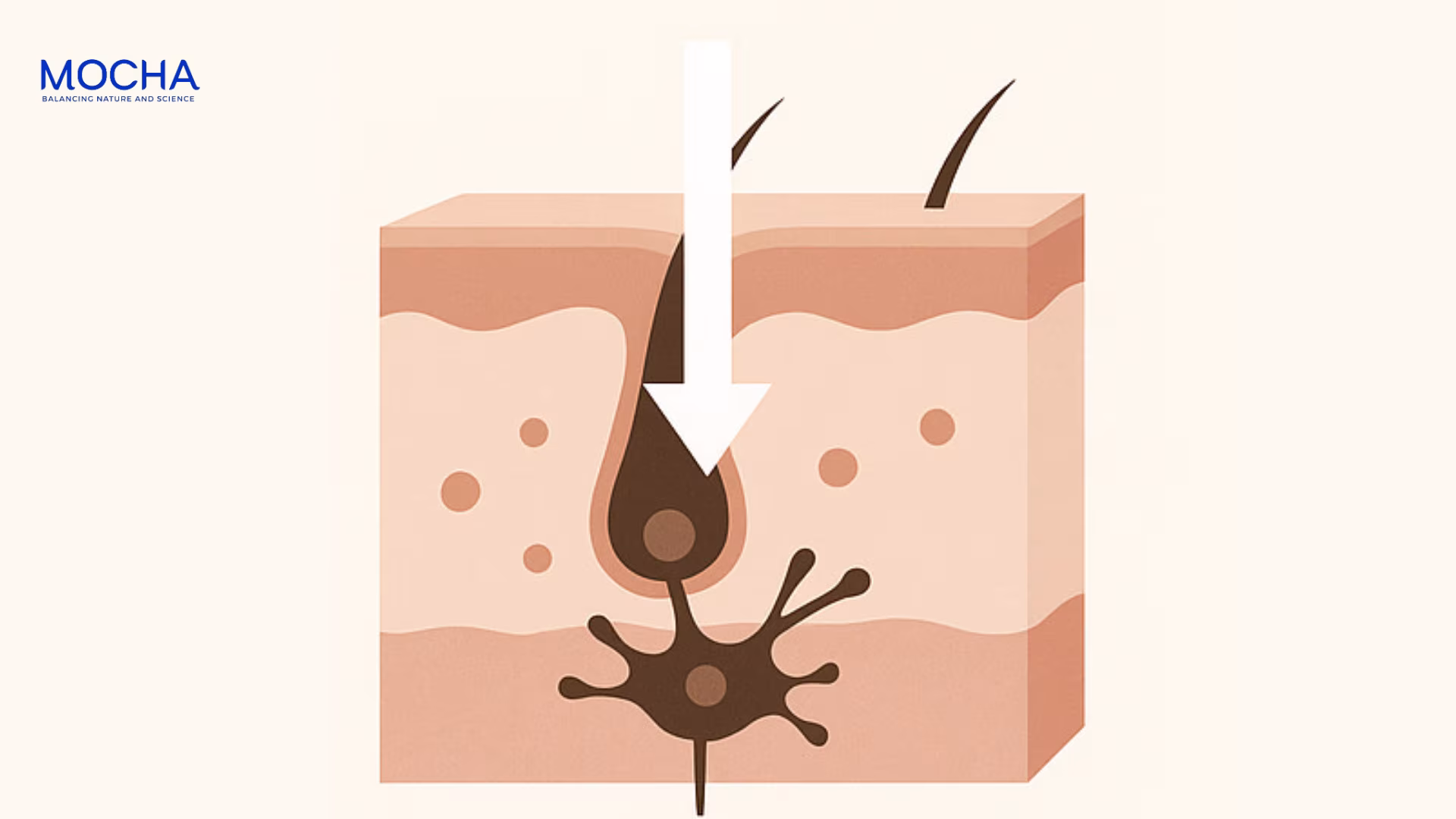 Top 4 hoạt chất giúp mờ nám nhanh chóng mà không gây bào mòn da