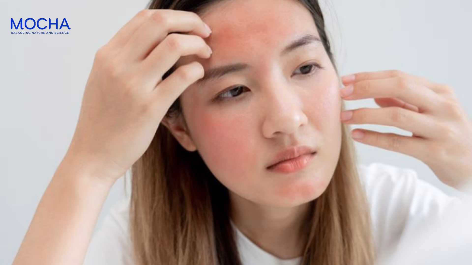 5 sự thật về việc peel da có làm mỏng da không? Hay gây hại cho hàng rào bảo vệ?