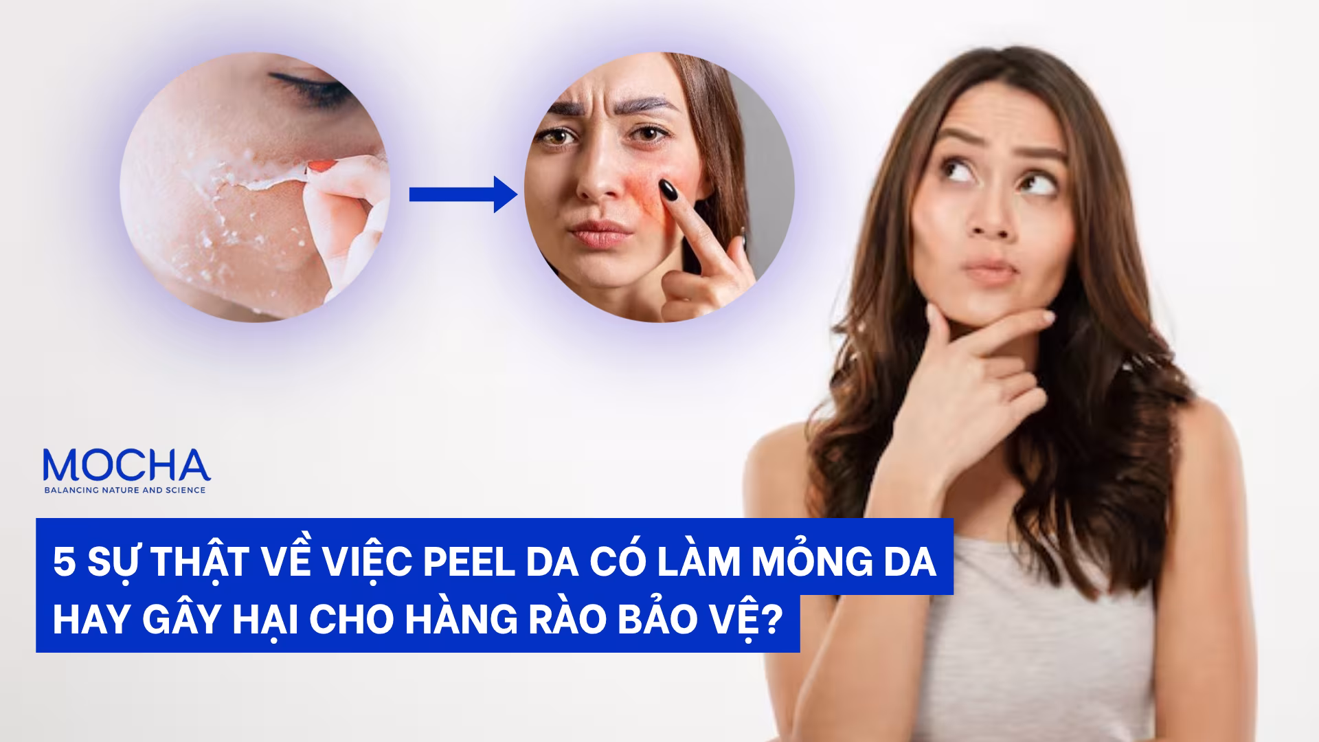 5 sự thật về việc peel da có làm mỏng da không? Hay gây hại cho hàng rào bảo vệ?