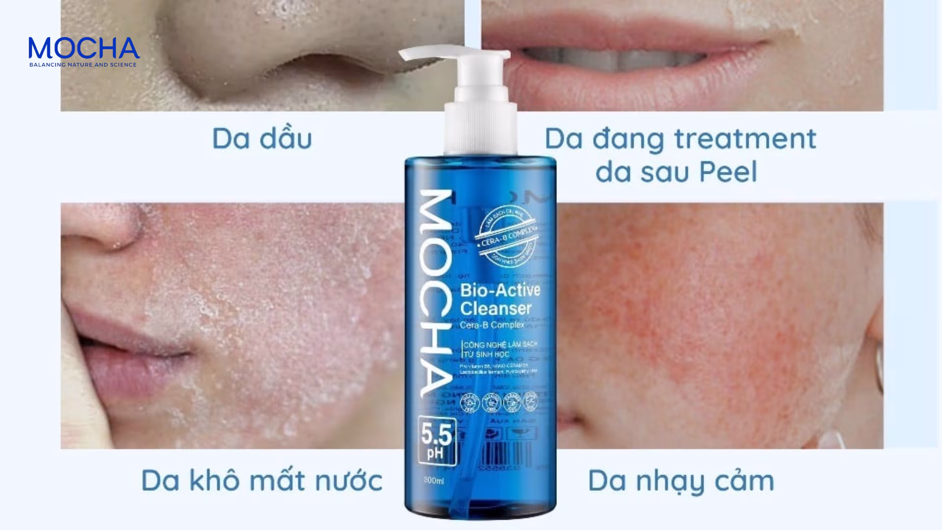 Peel da xong nên dùng sản phẩm gì? Quy trình chăm sóc 4 bước cùng Mocha