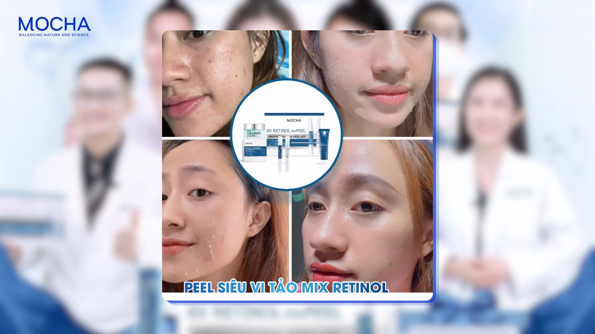 Review Retinol Mix Peel Mocha: 10 ngày tái tạo da không gây bong tróc mạnh