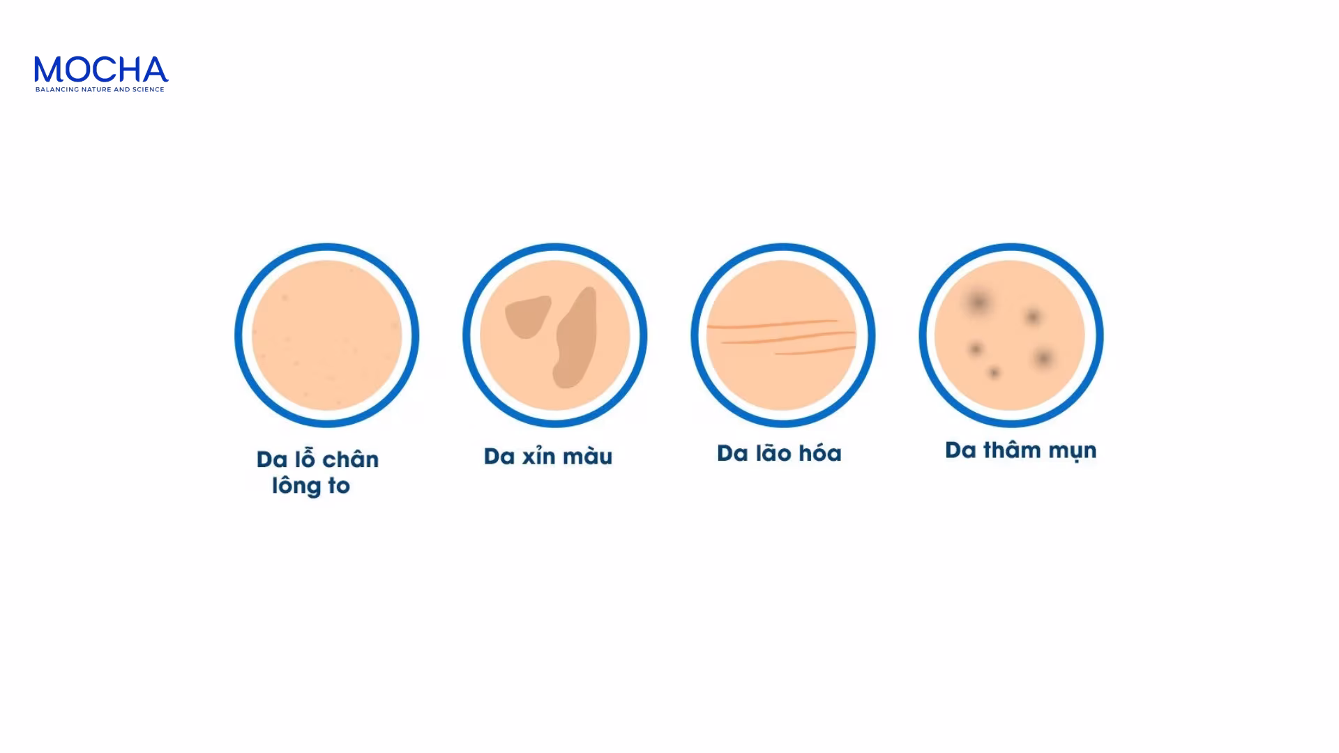 3 lý do peel nám là bước quan trọng trong điều trị nám da