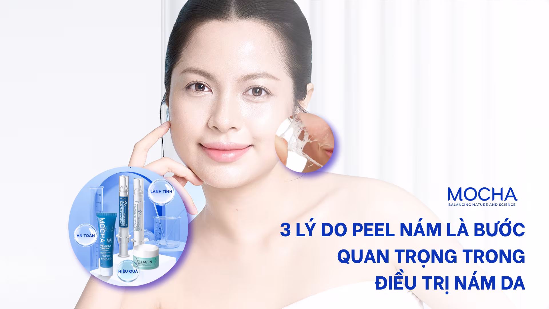 3 lý do peel nám là bước quan trọng trong điều trị nám da