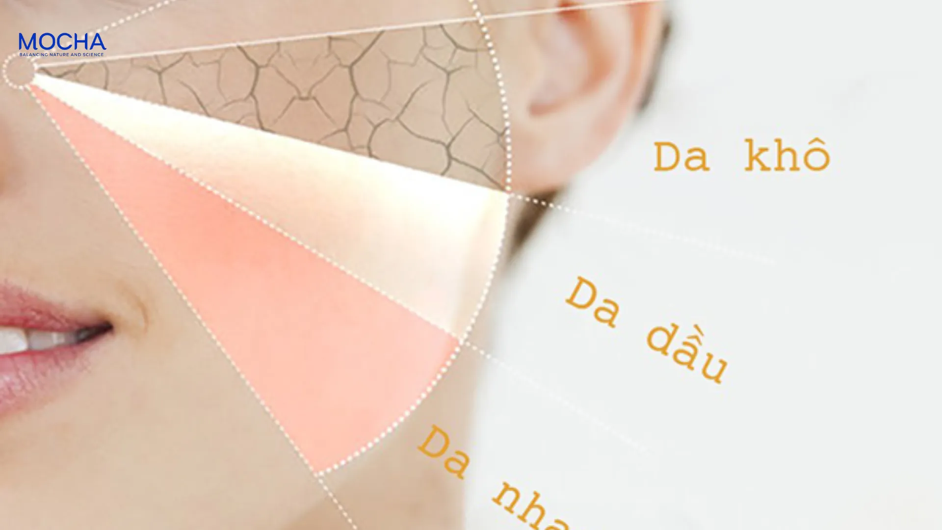 Tại sao da nám mảng thường đi kèm khô nhăn và mất nước? Giải pháp 2 trong 1 từ Mocha