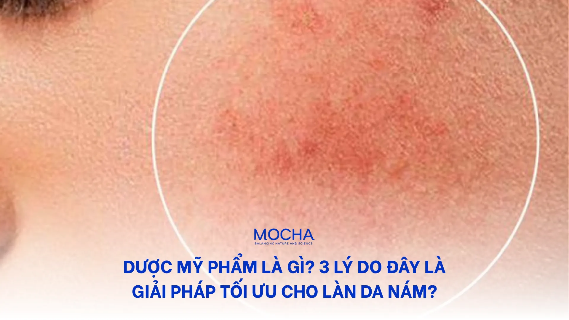 Dược mỹ phẩm là gì? 3 lý do đây là giải pháp tối ưu cho làn da nám?