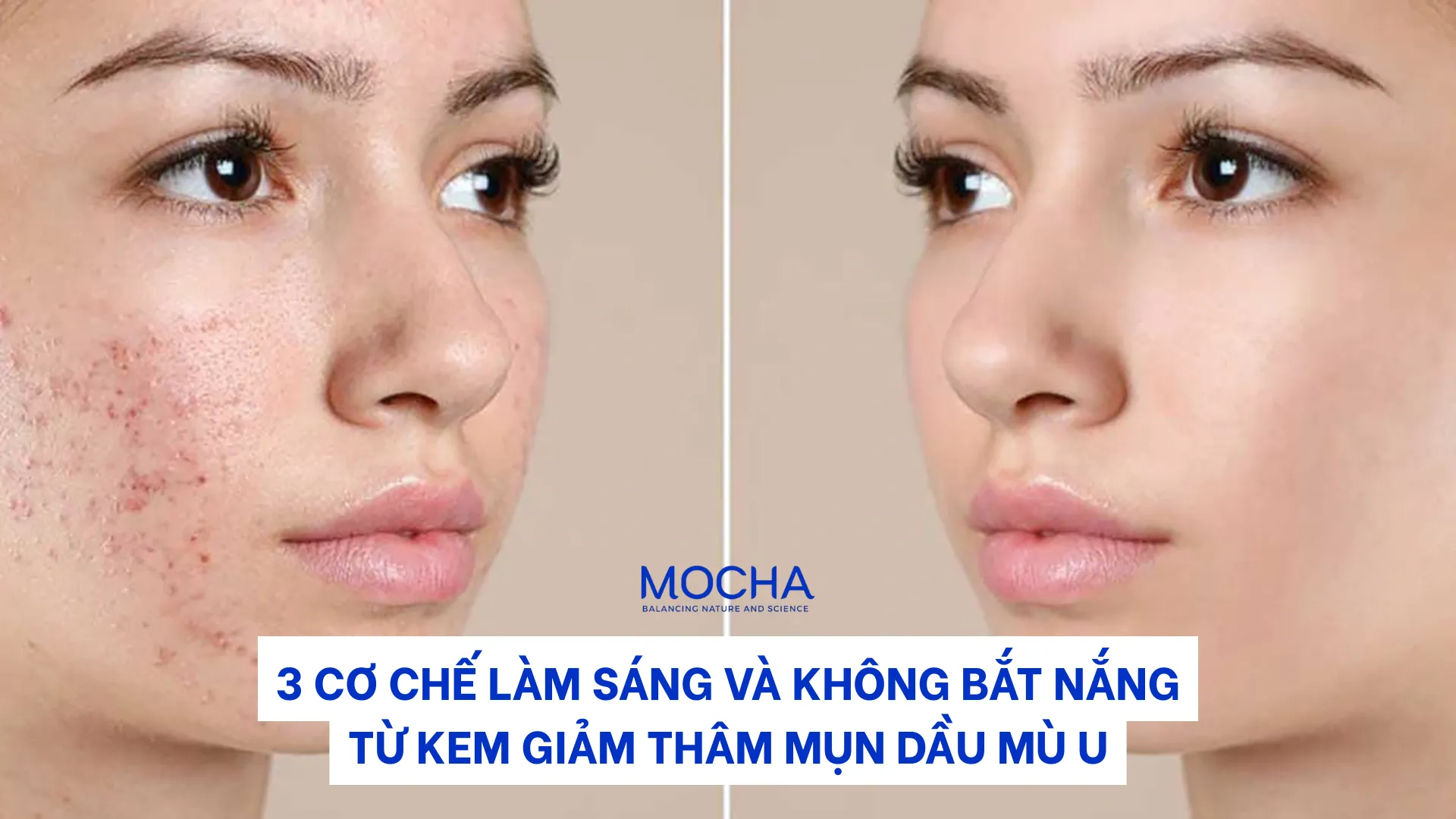 3 cơ chế làm sáng và không bắt nắng từ kem giảm thâm mụn dầu mù u