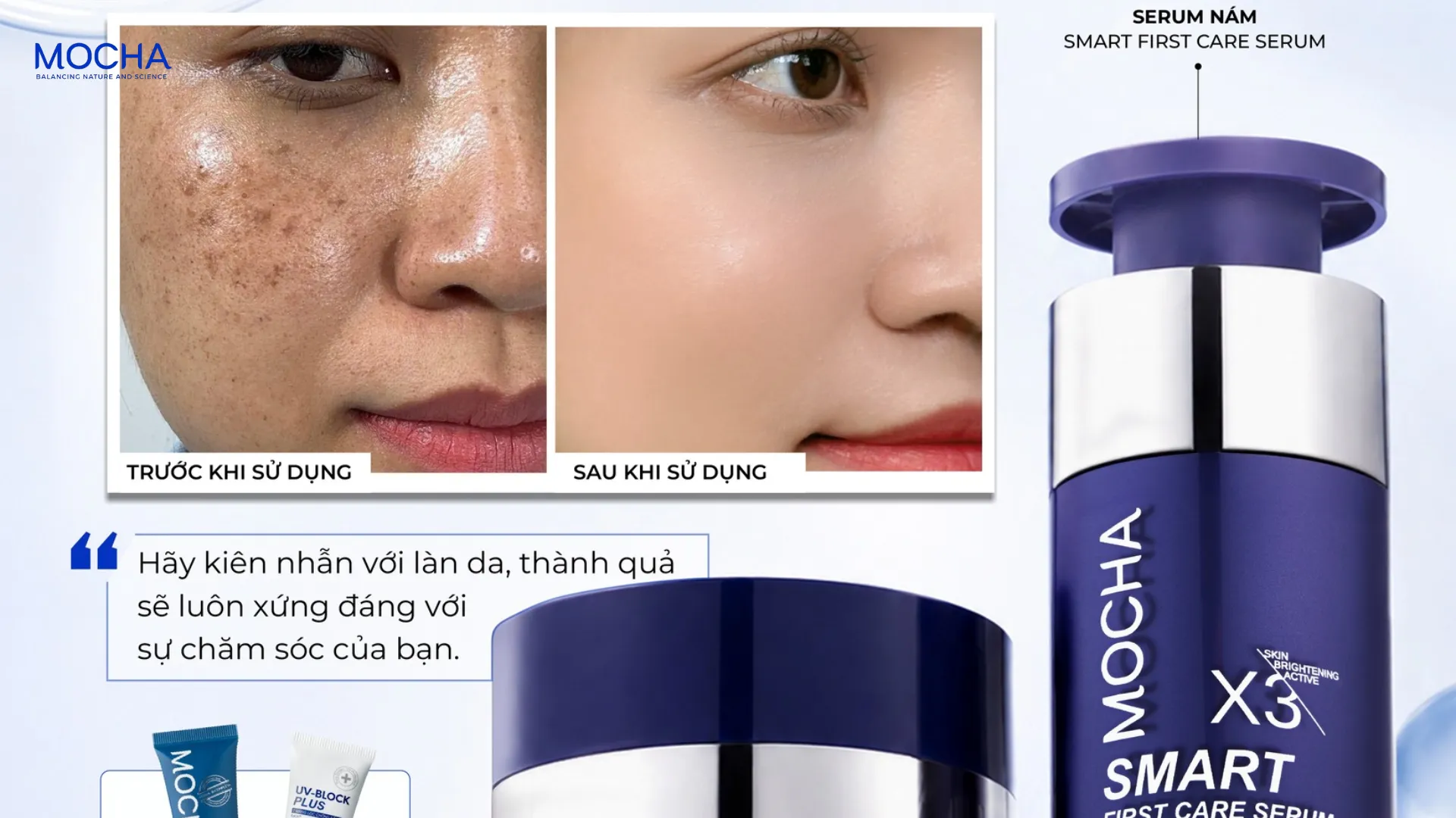 Nám mờ đi khi nào? 5 dấu hiệu tích cực khi dùng serum trị nám bạn cần biết