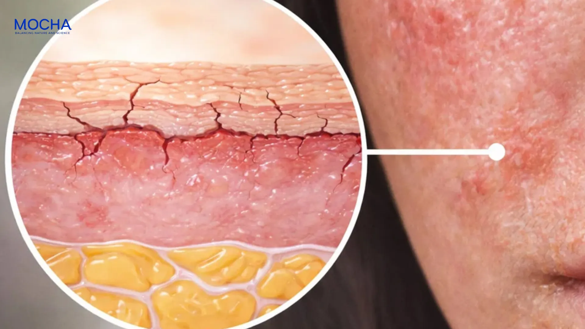 Peel da có tốt không? Giải đáp 4 lợi ích từ chuyên gia