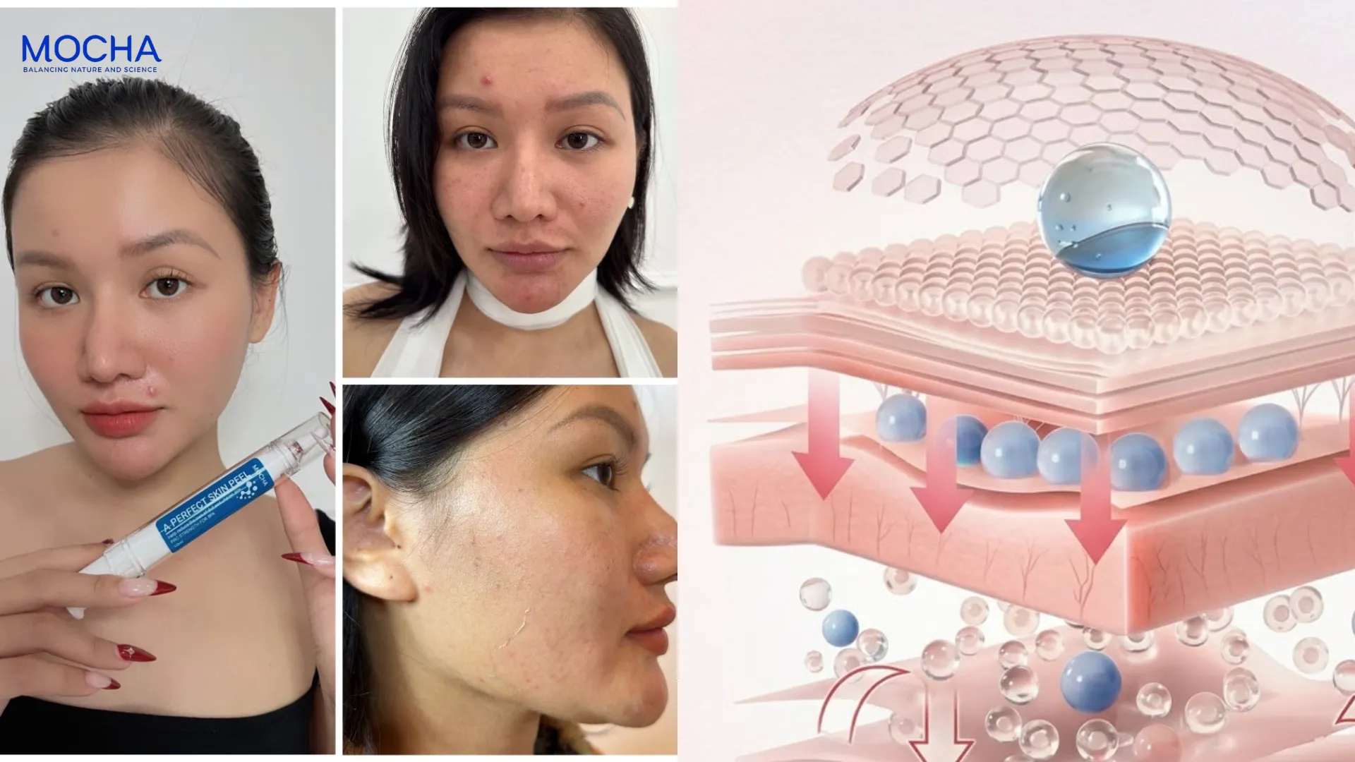 Retinol Mix: Công thức độc quyền kết hợp Retinol và 2 sức mạnh cốt lõi