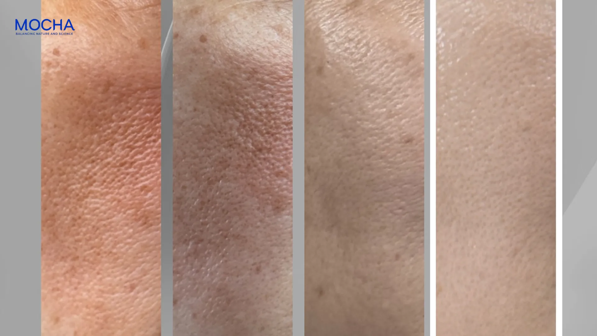 Review kem nám Mocha: Hơn 83% khách hàng quay lại sau sử dụng lần đầu tiên!