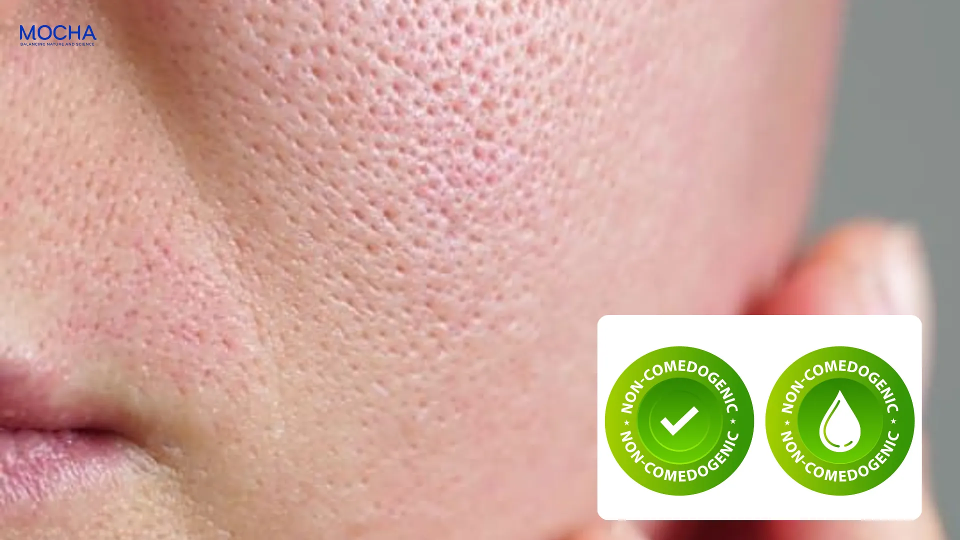 Giải mã thuật ngữ Non-comedogenic: 3 lý do kem dưỡng Mocha không gây mụn?