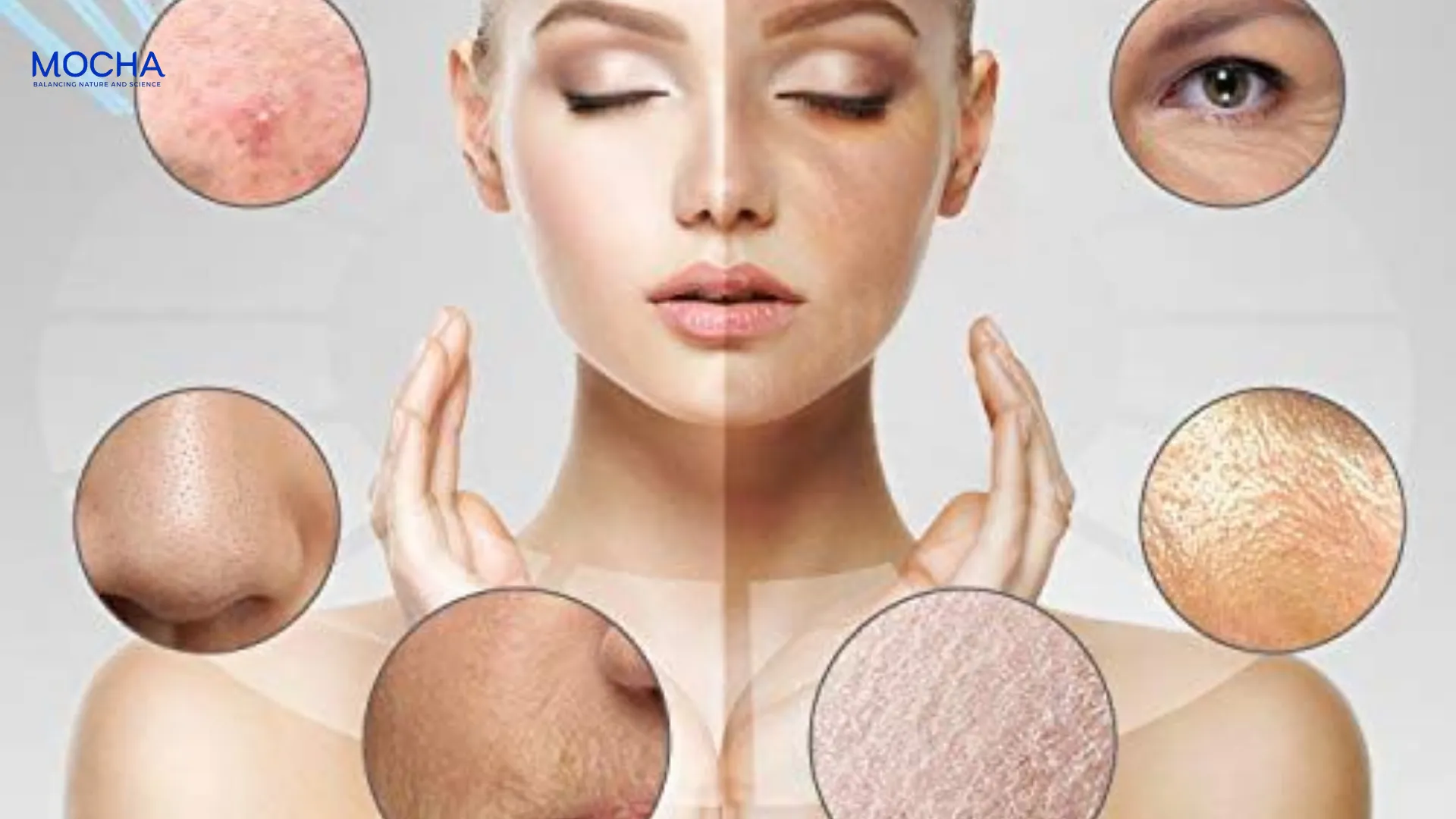 Tác dụng của thuốc trị nám và dược mỹ phẩm: Góc nhìn khoa học từ chuyên gia da liễu