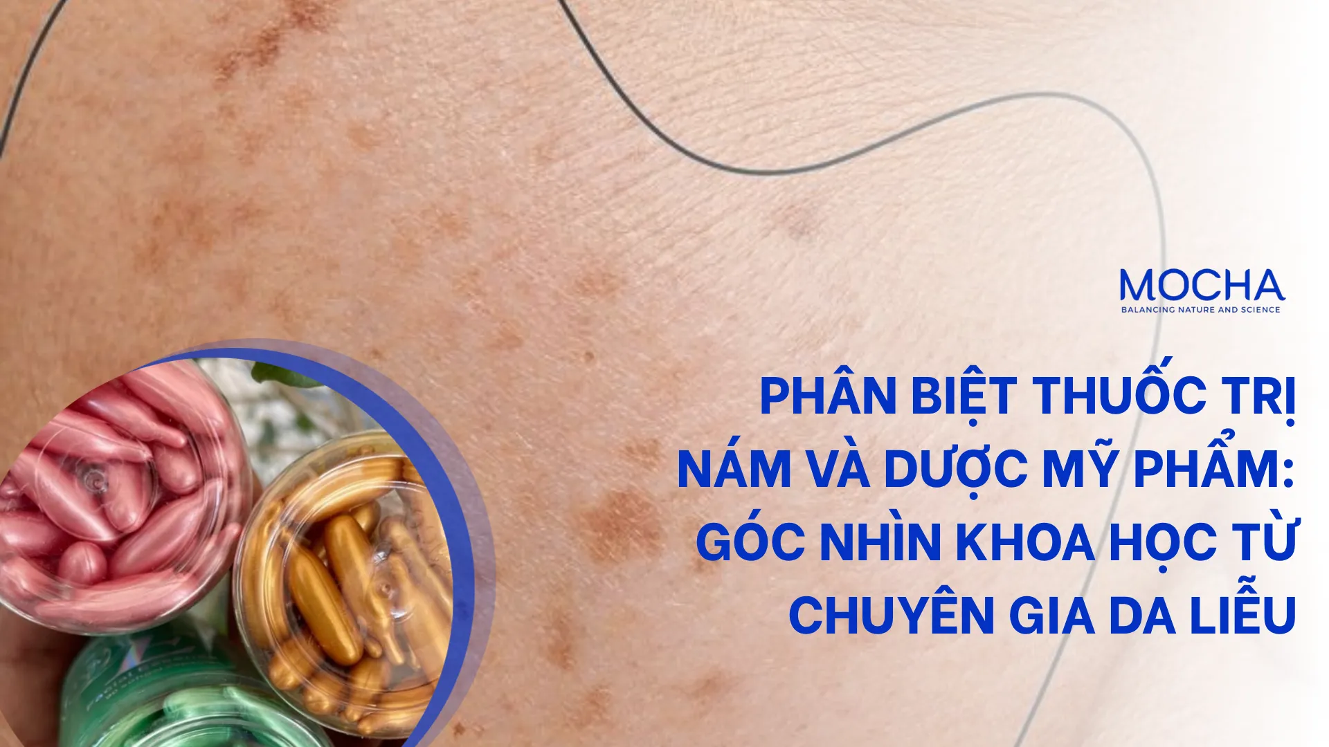 Tác dụng của thuốc trị nám và dược mỹ phẩm: Góc nhìn khoa học từ chuyên gia da liễu