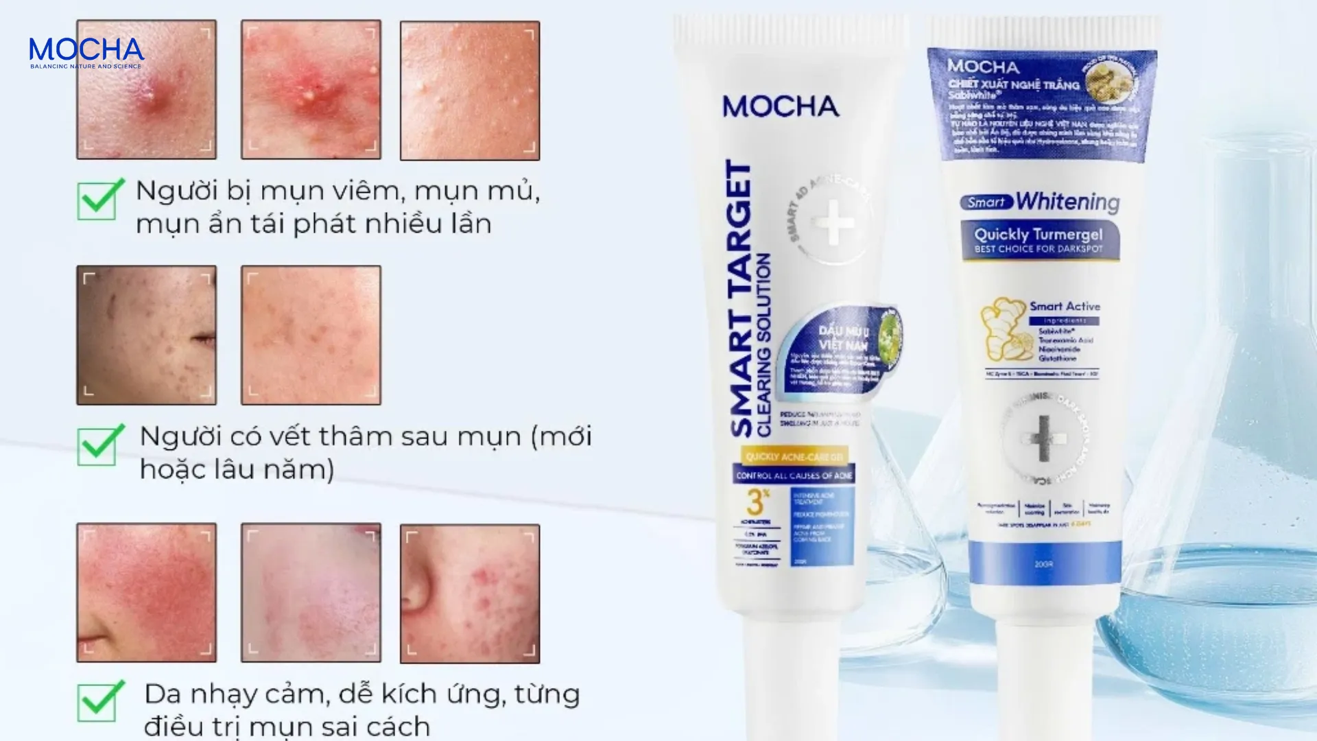 Khi nào nên dùng thuốc bôi mụn, khi nào nên dùng kem dưỡng giảm mụn?