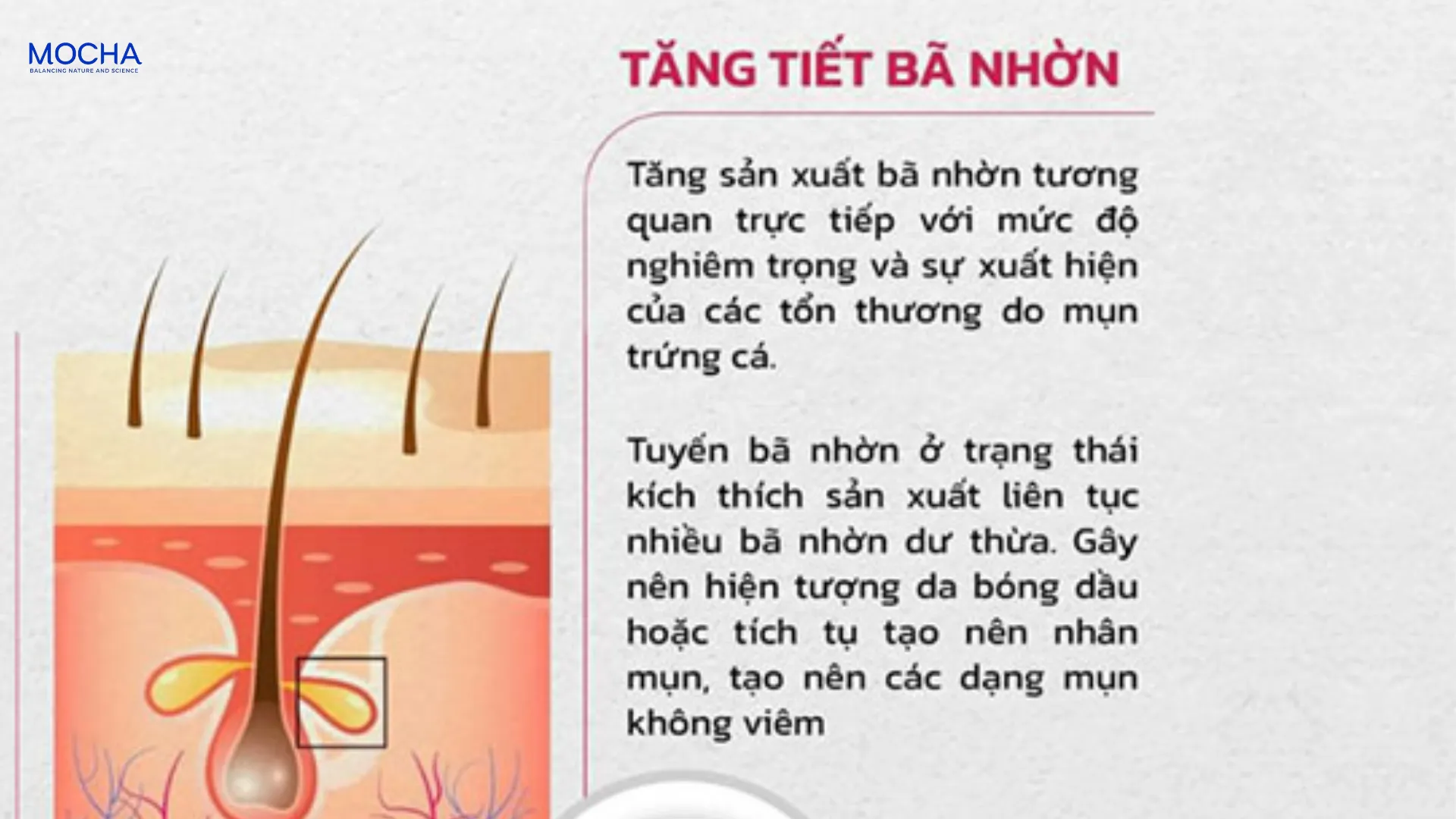 5 quy tắc trị thâm mụn tuổi dậy thì mà các học sinh không được quên