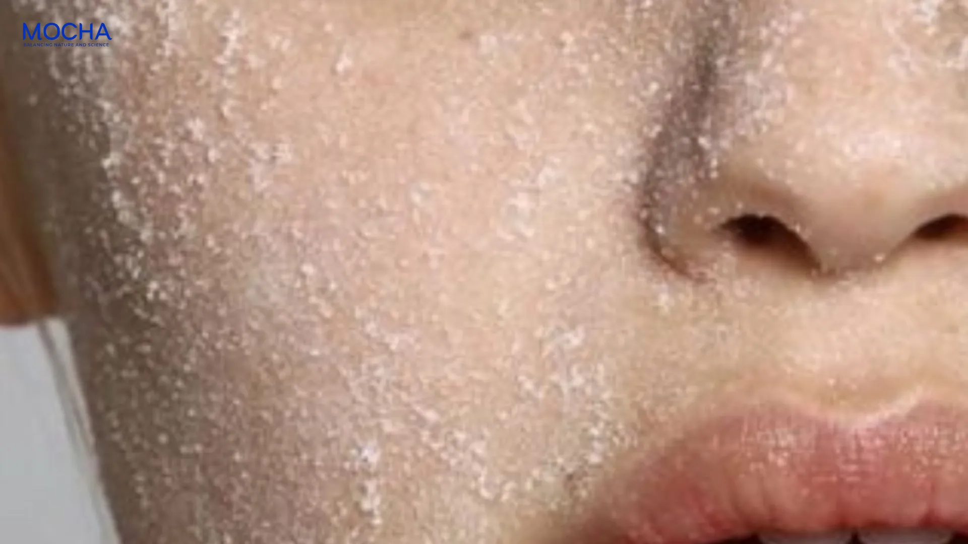 Peel da xong có được dùng retinol không và cách dùng an toàn nhất