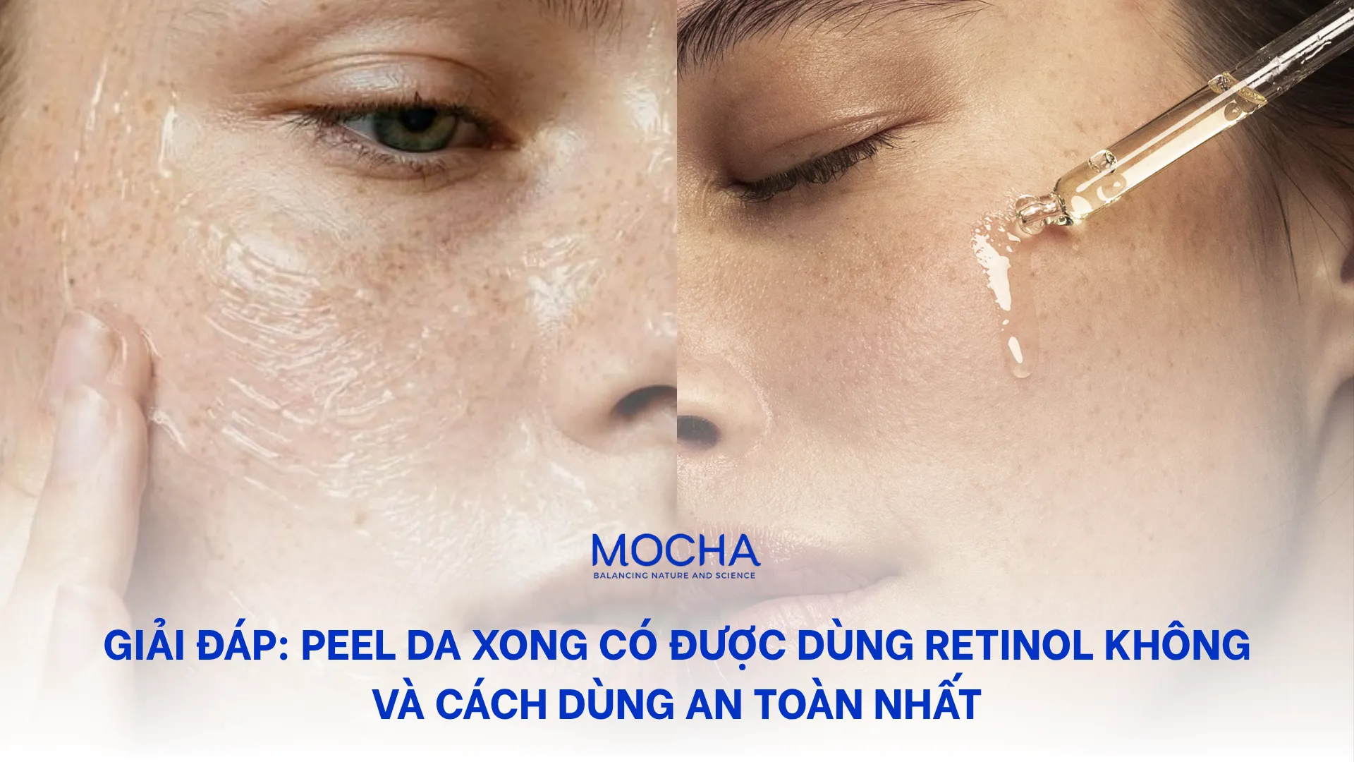 Peel da xong có được dùng retinol không? 2 giai đoạn an toàn
