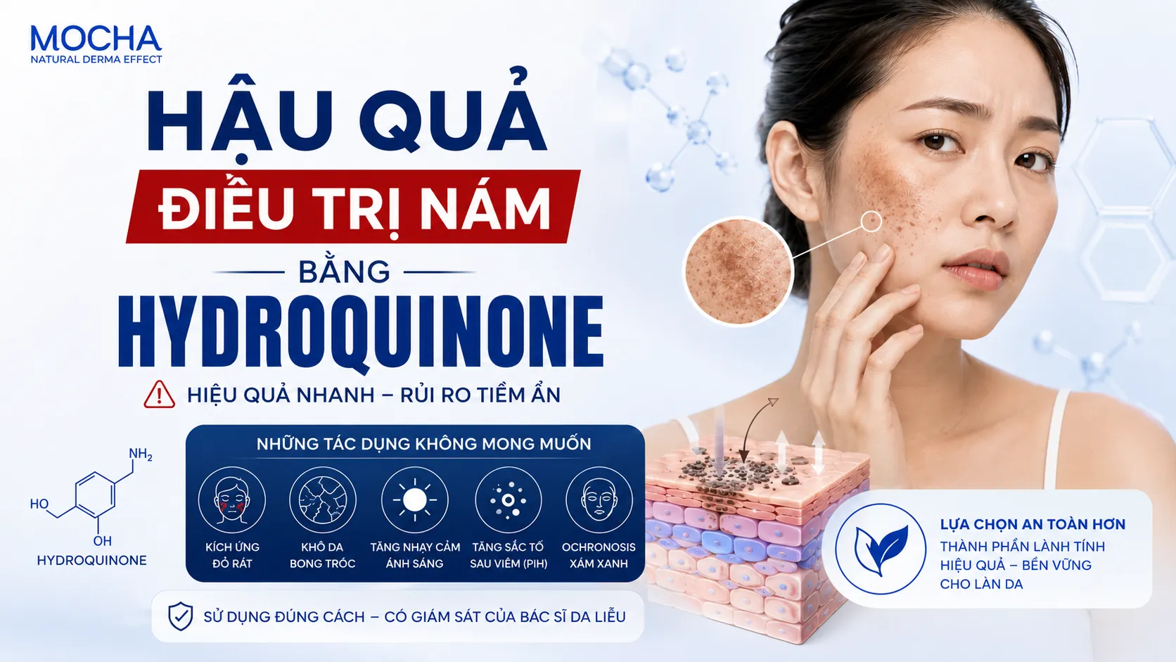 HẬU QUẢ VIỆC ĐIỀU TRỊ NÁM BẰNG HYDROQUINONE