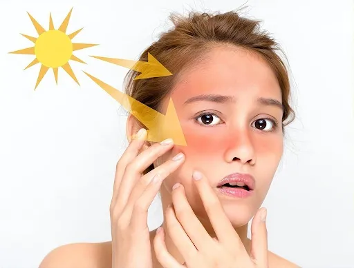 NHỮNG THÓI QUEN SINH HOẠT CÓ THỂ GÂY SẠM NÁM NẶNG HƠN